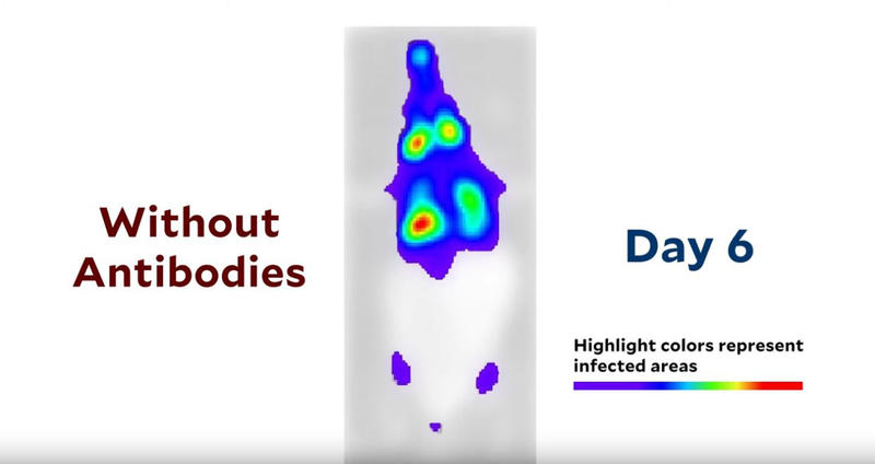 Raspandirea coronavirusului in organism, Foto: Captura YouTube