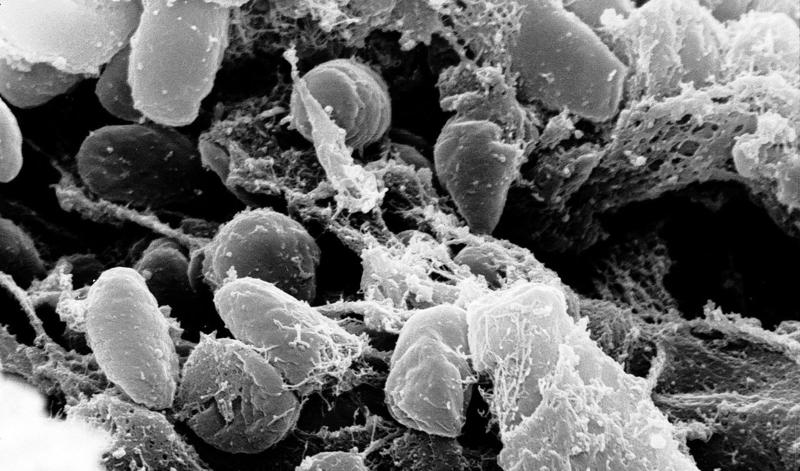 Yersinia Pestis, Foto: HotNews