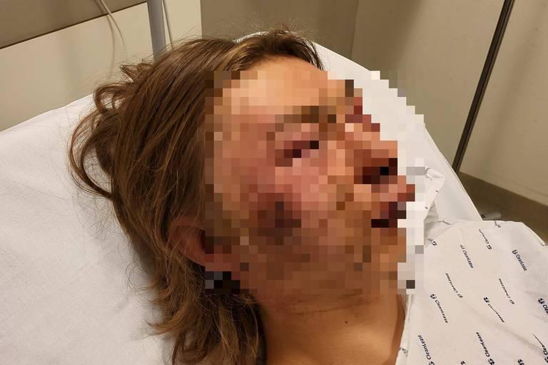 Tanarul a ajuns in spital cu fata tumefiata, Foto: La Libre.be