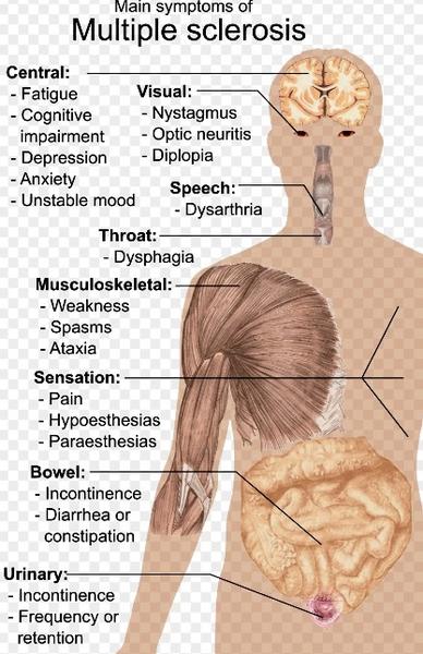 Simptome, Foto: Wikipedia