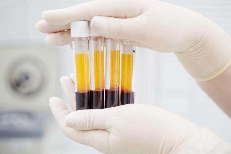 Victimele nevăzute ale pandemiei de COVID-19, Foto: Shutterstock