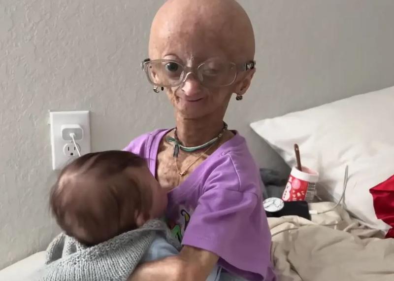 Adalia Rose Williams suferea de una din cele mai rare afectiuni genetice cunoscute, Foto: Captura YouTube