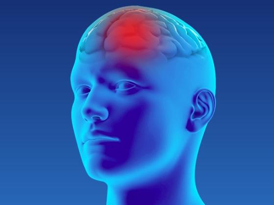 Accident vascular cerebral, Foto: Asociatia ALIA