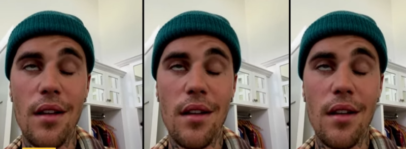 Justin Bieber, paralizie faciala, Foto: YouTube