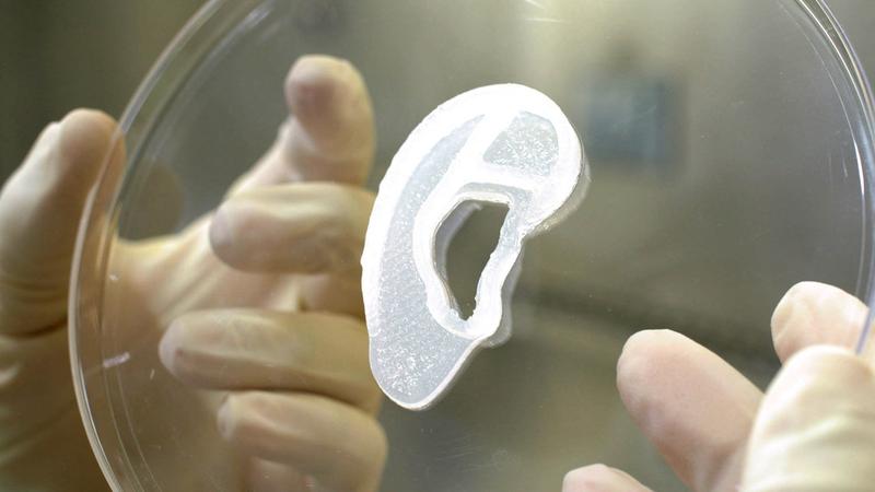 Implant de ureche printat 3D, Foto: Handout / AFP / Profimedia