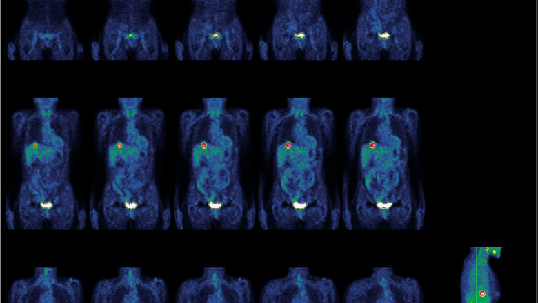 Digi24, Foto: Hotnews