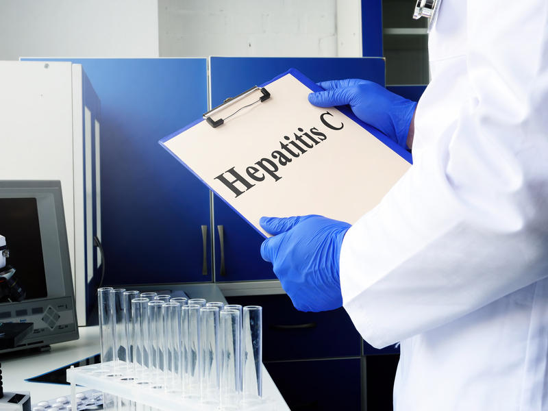 Hepatită, Foto: Dreamstime