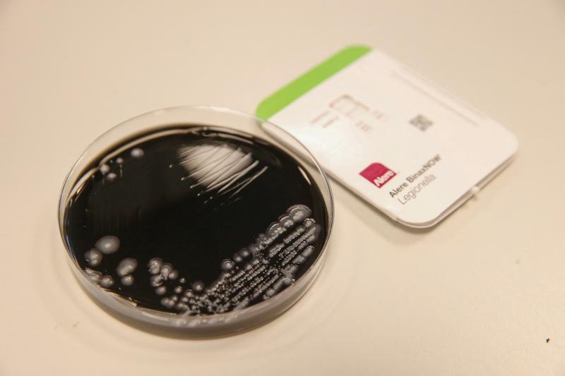 test antigen pentru detectarea bacteriei legionella, Foto: NICOLAS MAETERLINCK / AFP / Profimedia