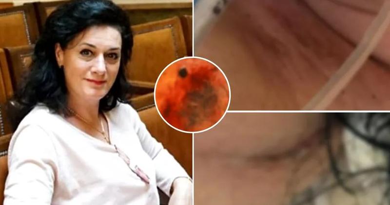 ”Aceste fotografii au salvat cazul”. Cum arăta trupul mezzosopranei Maria Macsim Nicoară, după ce a fost găsită prăbușită pe scări, Foto: fanatik.ro