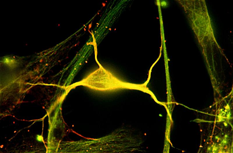 neuroni, Foto: ROBERT MCNEIL, BAYLOR COLLEGE OF MEDICINE / Sciencephoto / Profimedia