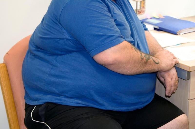 Pacient cu obezitate, Foto: Life in View / Sciencephoto / Profimedia Images