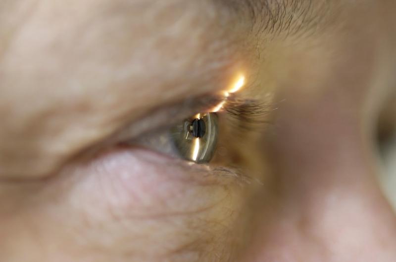 Examinare oftalmologică, Foto: Dr P. Marazzi / Sciencephoto / Profimedia Images