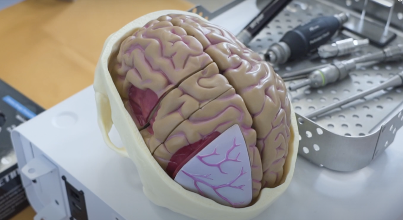 Imagini de la conferința care pune România pe harta neuro-oncologiei mondiale, Foto: Hotnews