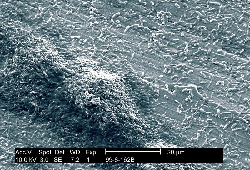 Bacteria legionella care provoaca legioneloza, Foto: BSIP-Photoshot / Avalon / Profimedia Images
