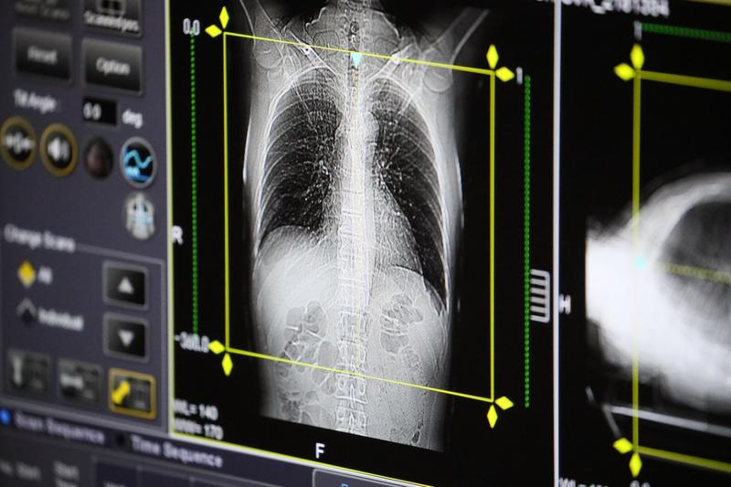 Tomografie pulmonară, Foto: Vladimir Gerdo / TASS / Profimedia