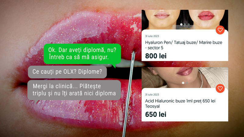Injectarea buzelor cu acid hialuronic, colaj, Foto: Nikolay Litov / Alamy / Alamy / Profimedia (Edited: Adi Iacob)