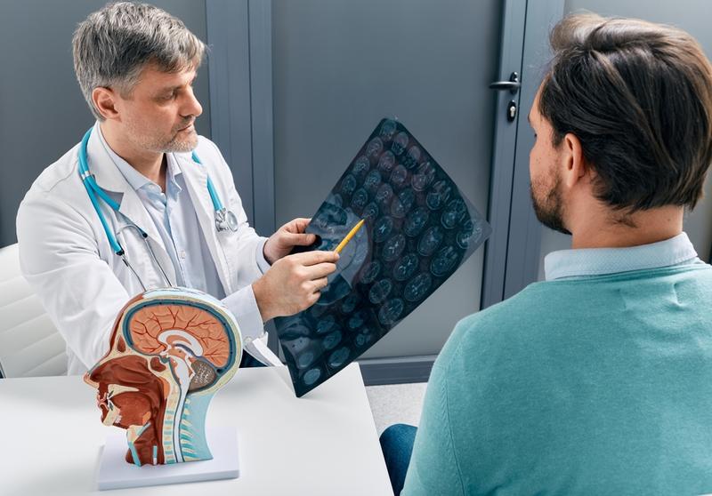 Atacul vascular cerebral afectează din ce în ce mai mulți tineri, Foto: Shutterstock