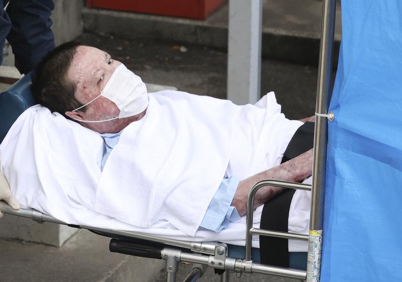 Shinji Aoba a suferit arsuri puternice in timpul incendiului, Foto: Tetsuya Kikumasa / Associated Press / Profimedia Images