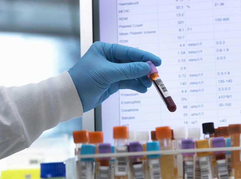 Mostra de sange, Foto: Andrew Brookes / ImageSource / Profimedia