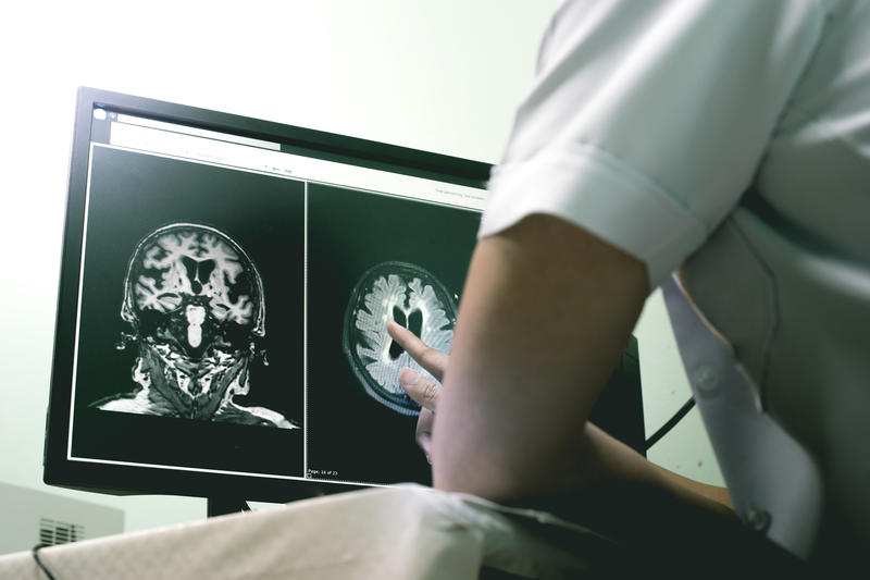 Demență timpurie, Foto: © Atthapon Raksthaput | Dreamstime.com