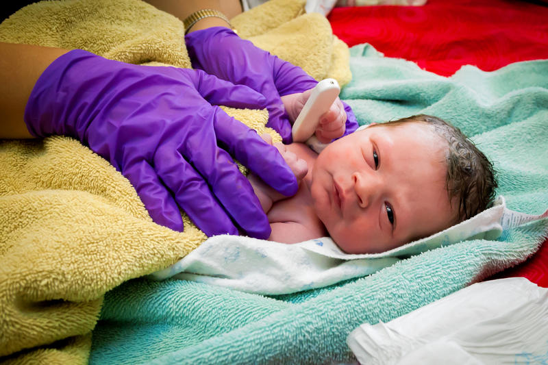 Sistemul de notare APGAR ajută medicul să aprecieze starea generală de sănătate a copilului la naștere, Foto: © Jbrown777 | Dreamstime.com