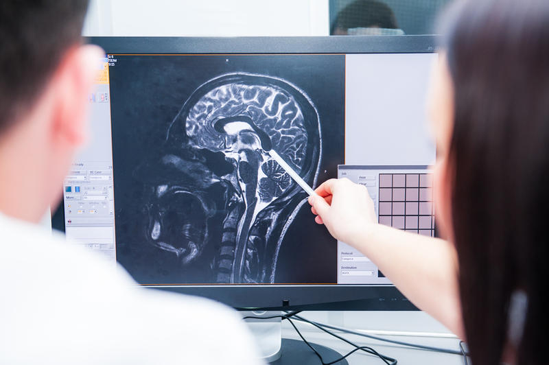Cu cât scorul de îngrijire a creierului este mai mare, cu atât riscul de demențe și de accident vascular cerebral scade. Vestea bună e că noi ne putem crește acest scor, Foto: Shutterstock