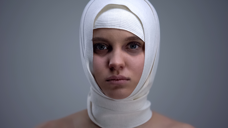 Femeie cu traumatism cranio-cerebral / Foto: Motortion | Dreamstime.com