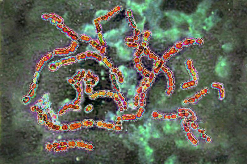 Bacterii Streptococcus pyogenes vazute la microscop, Foto: Cavallini James-BSIP / Imago Stock and People / Profimedia