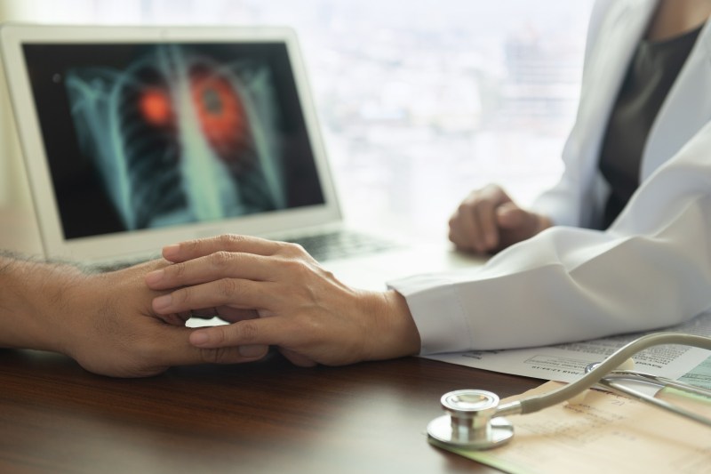 #Medici buni Conf. Dr. Gilda Popescu, MedLife: „O tumoră pulmonară are nevoie de câțiva ani pentru a ajunge la dimensiunea de 1 centimetru. Atunci poate fi evidențiată pe radiografia toracică, după care creșterea este exponențială“