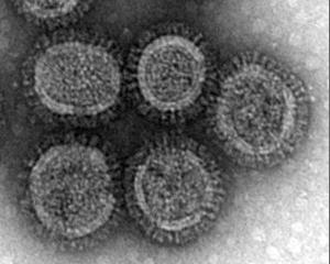 H5N1, Foto: Captura University Wisconsin-Madison