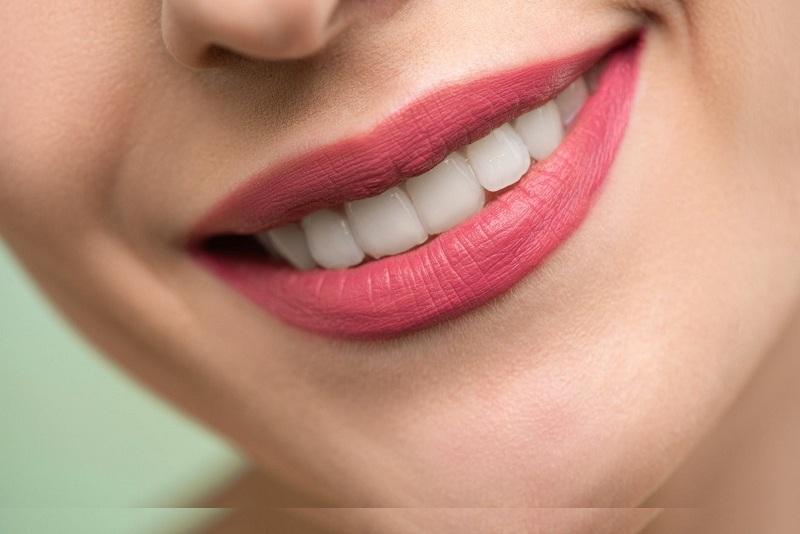 Implant dentar, Foto: https://draristide.ro/