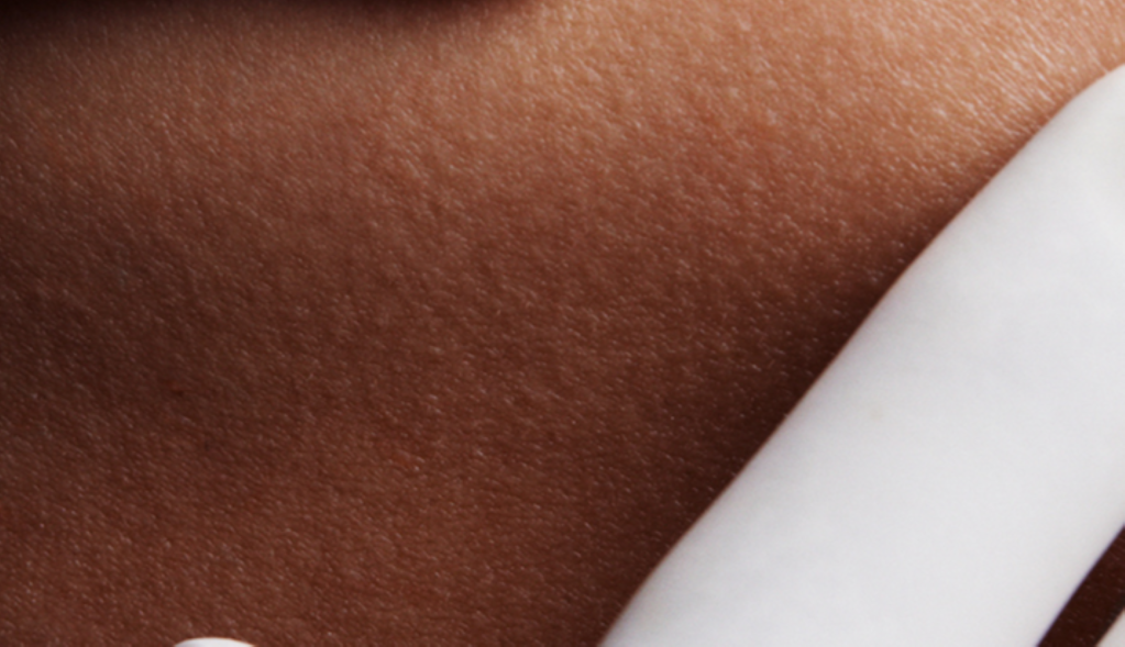 Diferențe între pete pigmentare și melasma