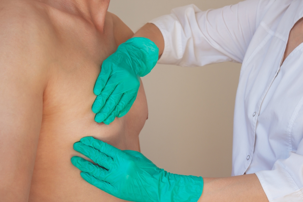 De cele mai multe ori, pacienții ajung la medic abia când apar simptome evidente, precum retracția sau sângerarea mamelonului. FOTO: Shutterstock