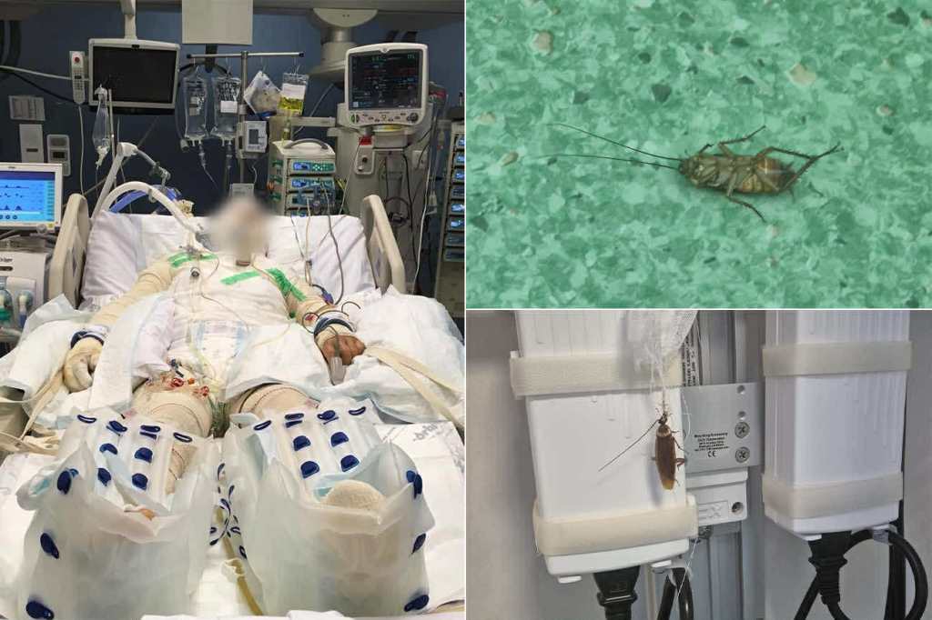 Imagini din secția de mari arși a Spitalului Floreasca / Foto: Facebook - Alina Alexandru