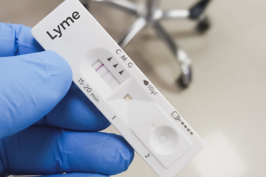 Boala Lyme: Ce este și cum se tratează infecția cauzată de căpușe