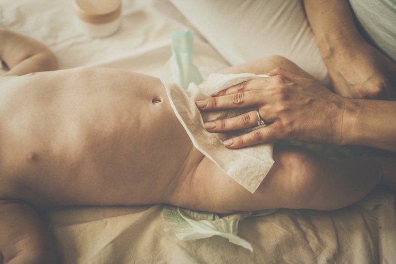 Fetiță sau băiețel, zona scutecului are nevoie de atenție specială: pielea e delicată, sensibilă și expusă zilnic la umezeală, căldură și frecare. FOTO: Shutterstock