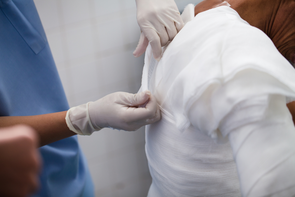 Tratament pentru arsuri. Fotografie ilustrativă / Shutterstock