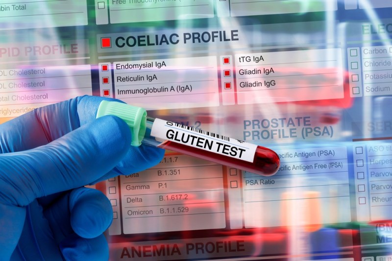 Predispoziția genetică la boala celiacă se poate depista printr-un test simplu. În ce situații se recomandă copiilor