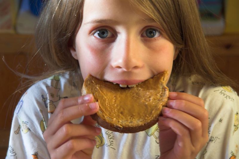 Prevalența celor mai comune alergii alimentare la copii a scăzut drastic în SUA, arată un studiu. Medicii au o explicație clară