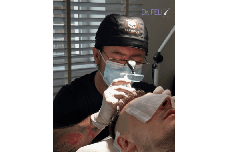 Este mai avantajos un transplant de păr în România la Dr. Felix Hair Implant din București?