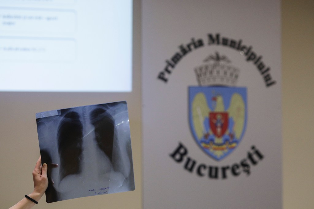 O persoană prezintă o radiografie pulmonară în timpul unei dezbateri tehnice privind calitatea aerului în București, la sediul Primăriei Municipiului București, joi, 23 ianuarie 2020. Inquam Photos / Octav Ganea