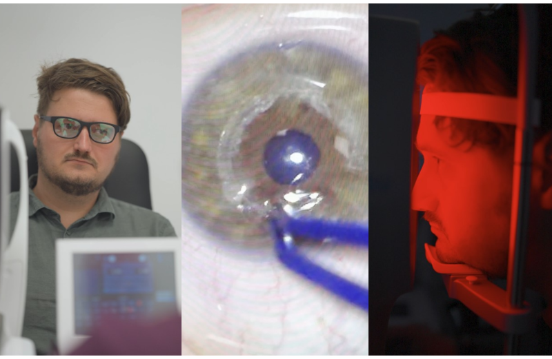 Ce afecțiune îți poate distorsiona vederea fără să-ți dai seama: keratoconusul