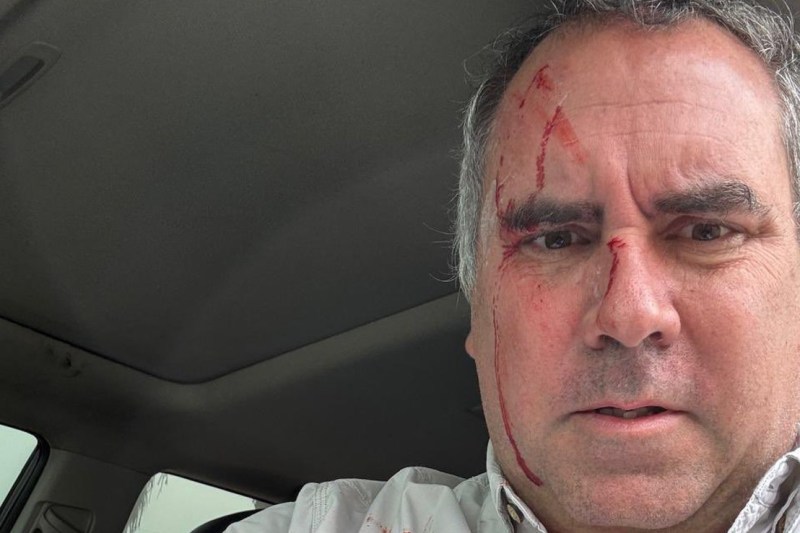 Tentativă de asasinat asupra unui candidat la prezidențialele din Peru. „Un început prost de campanie”