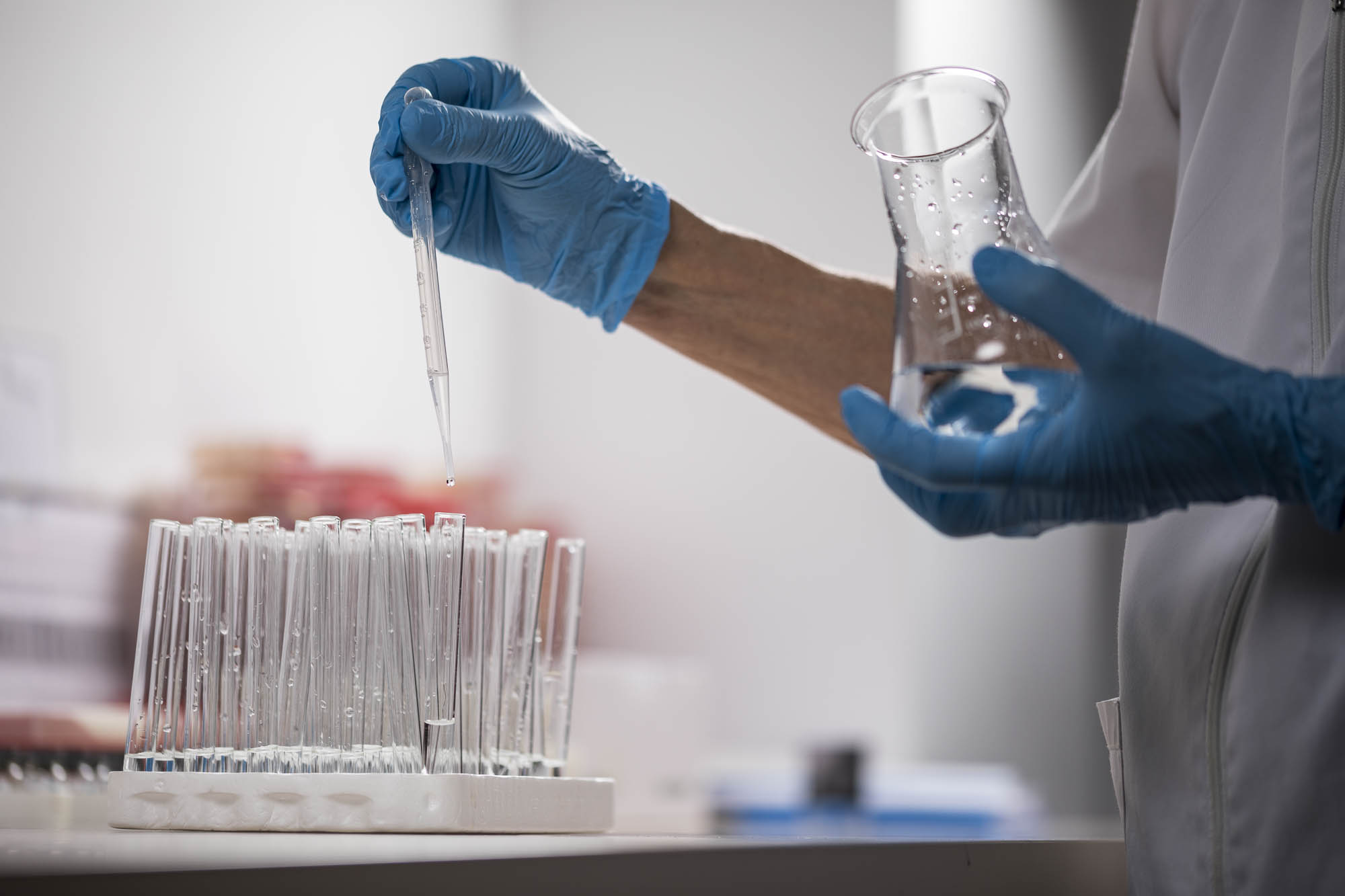 De ce fac femeile infecții urinare recurente: legătura cu sexul, menopauza și tratamentele greșite