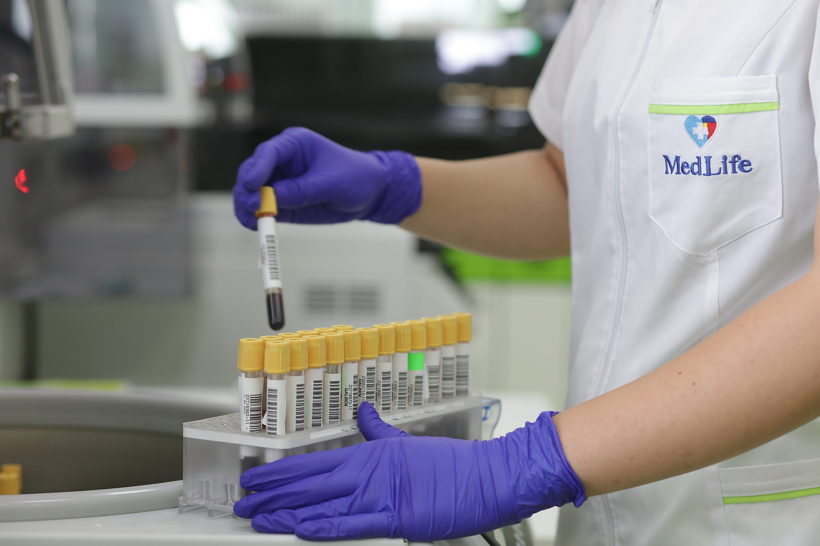 HPV: Infecţia poate fi asimptomatică ani de zile. Genotiparea identifică riscurile oncogene